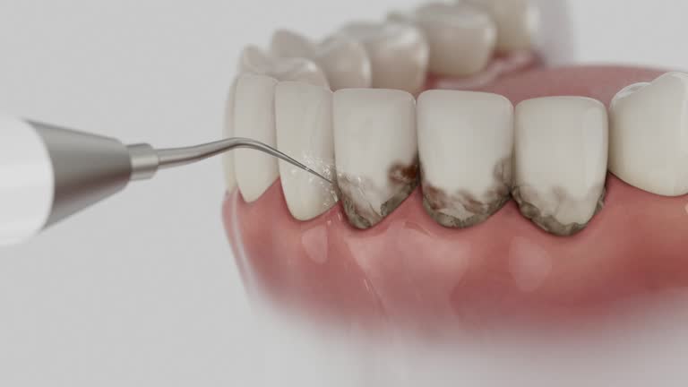 Reliable Dental contractor in Fredericktown, OH by Dentist Open Now